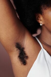 voor laser ontharen born voor laser ontharen born