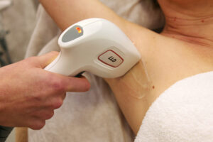 Rosacea behandeling Limburg Rosacea behandeling Limburg